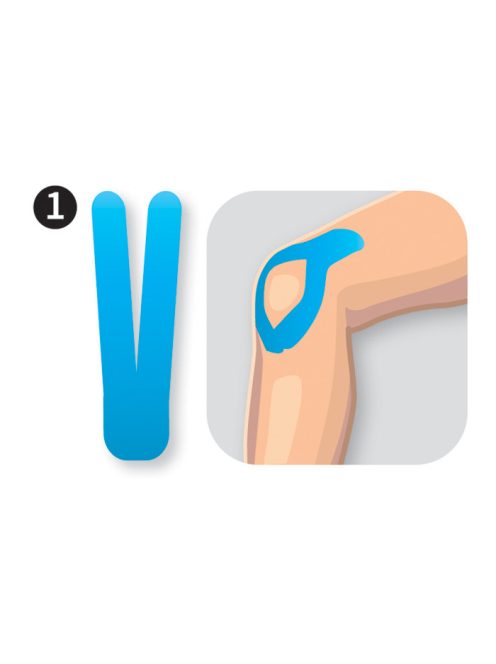 ACUTOP Classic Precut Kineziológiai Tapasz Térdre (Előre Vágott 8 adagos csomag)